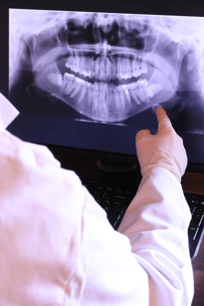 Best Emergency Dental Extractions in Lake Sherwood, CA