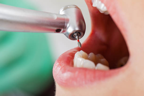 Best Emergency Dental Services for Seniors in Lake Sherwood, CA